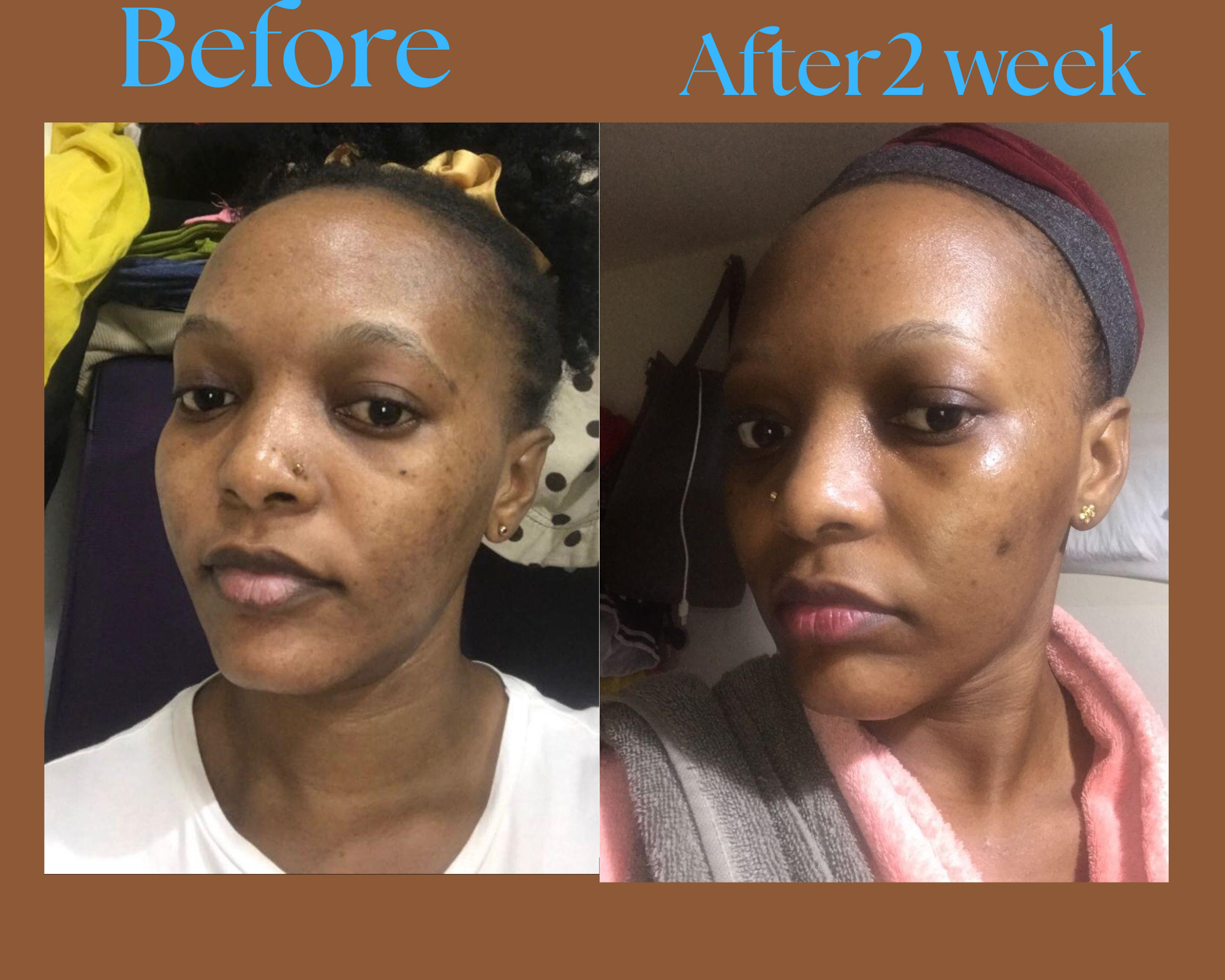 Before and after comparison of a woman's face with text indicating a two-week period.